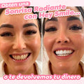 Blanqueador de dientes Hey Smile